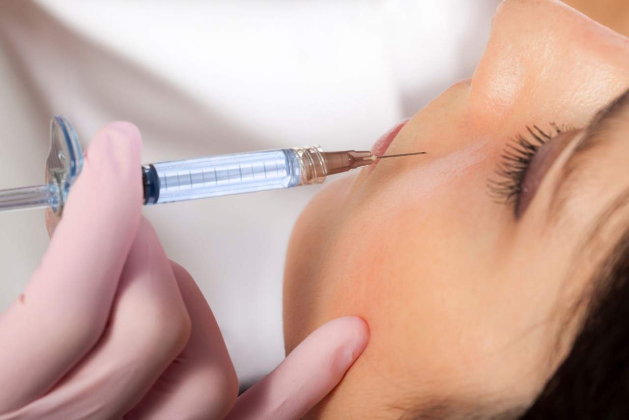 Los increíbles resultados de eliminar ojeras con ácido hialurónico en Barcelona