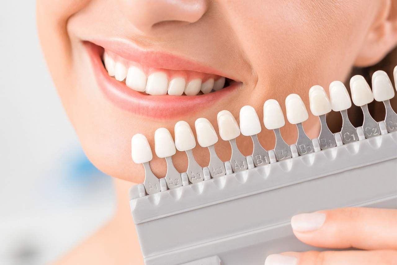 Clínica dental Helident en Sevilla: las búsquedas acerca de los implantes dentales en Sevilla