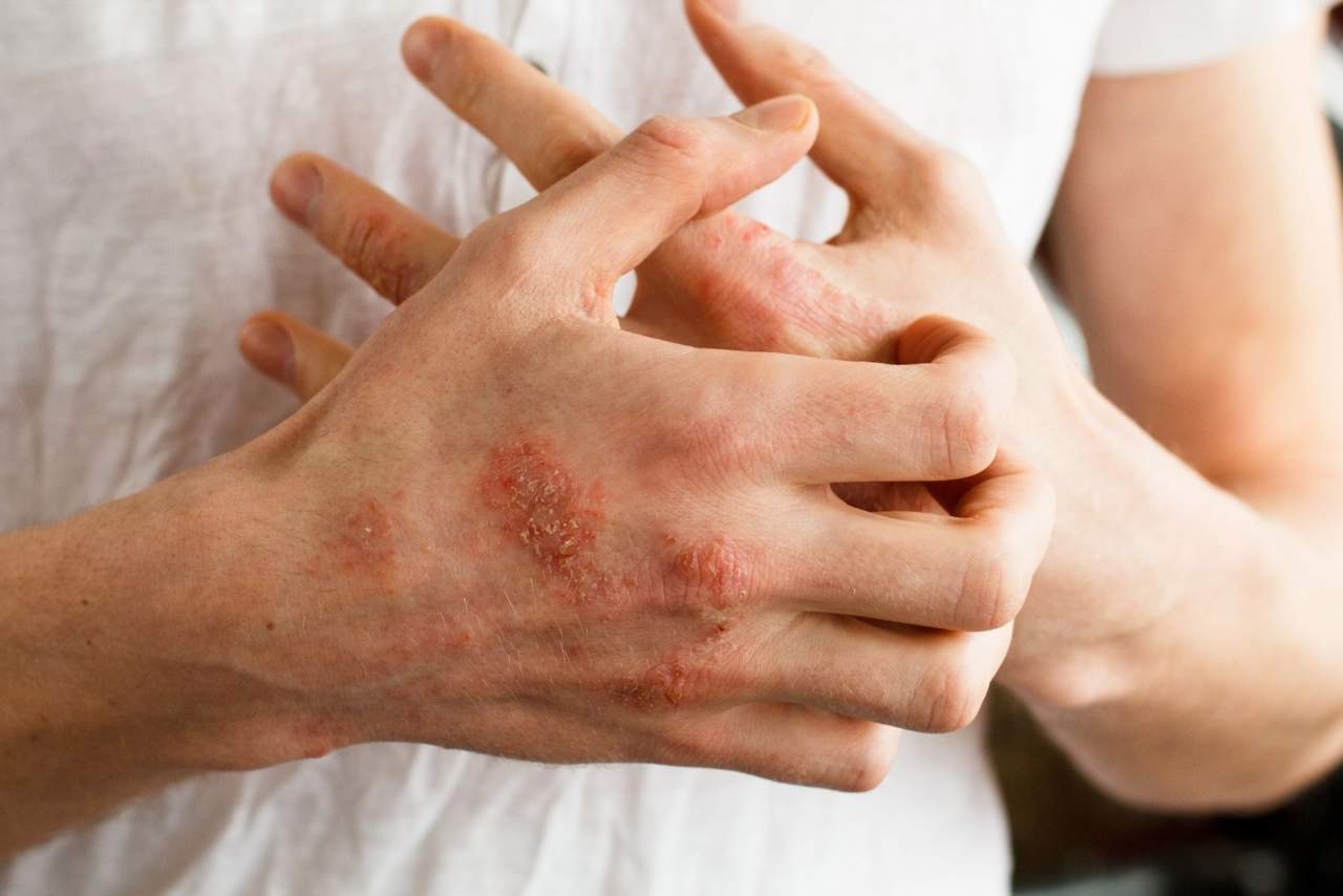 Tejido técnico para curar heridas: La revolución del tejido Muvu en Parafarmacia Integrativa