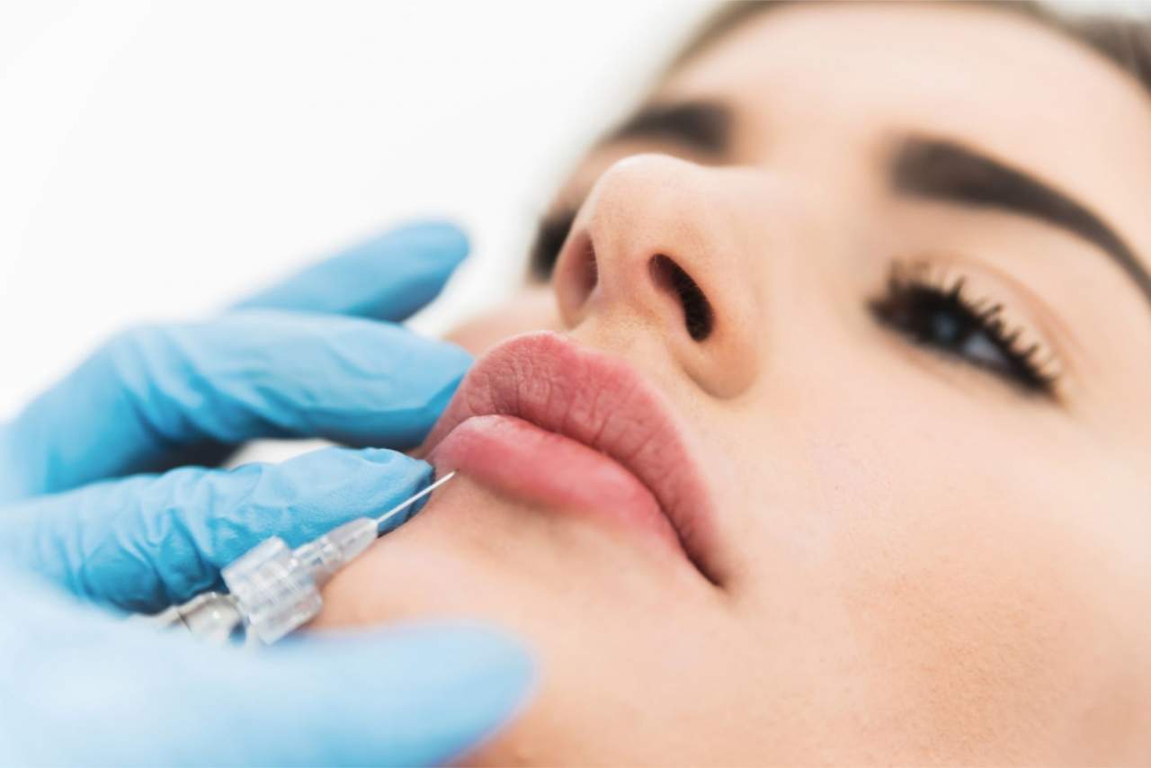 Tratamiento de aumento de labios en la Clínica Dr. Zito