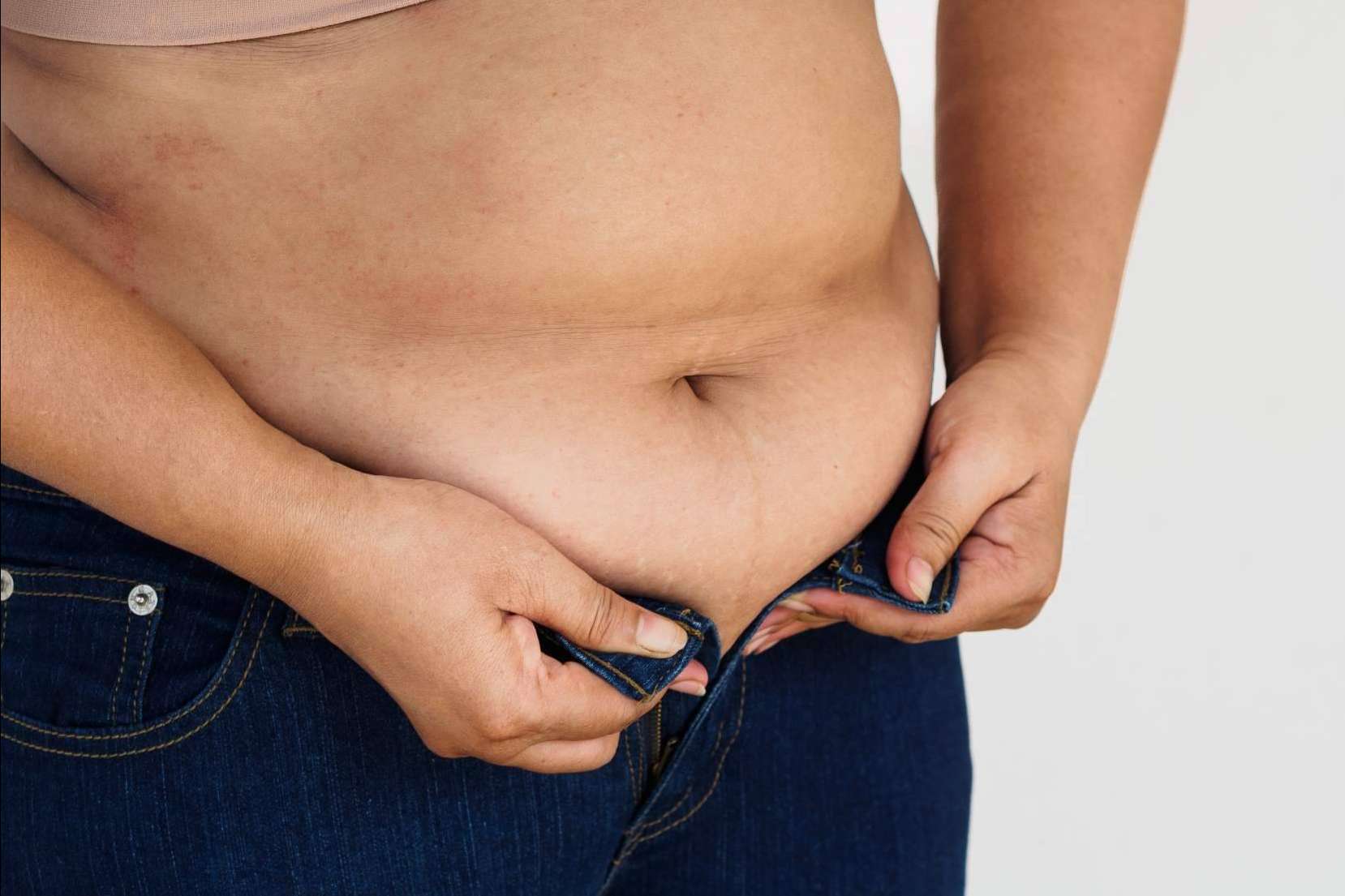 ¿Cuál es la diferencia entre la hidrolipoclasia 4D en Clínica Ciscar y la hidrolipoclasia convencional?