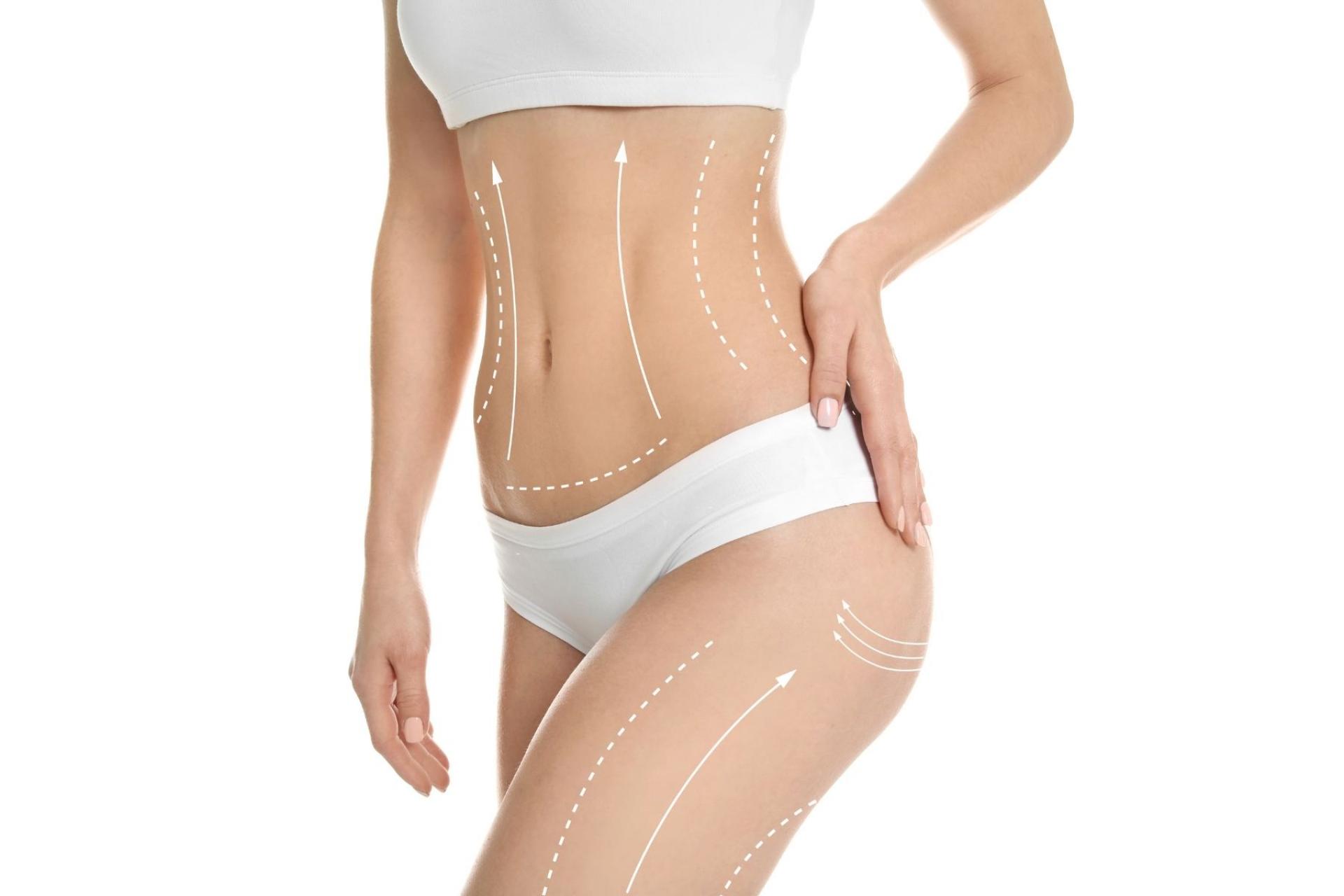 TightSculpting, el tratamiento corporal de la Clínica Fercasy