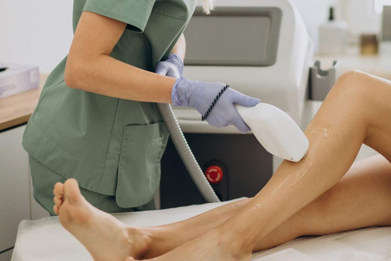 ¿Es efectivo el láser de depilación en Elche? AdaBeauty opiniones