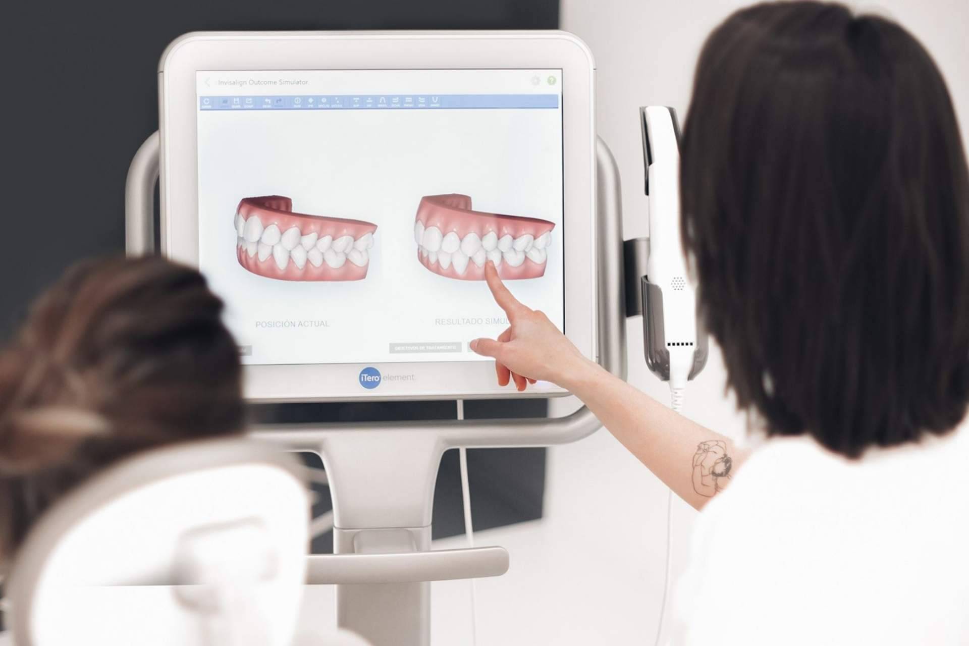 Conseguir una sonrisa perfecta con el tratamiento de ortodoncia invisible de la clínica dental Centros en Línea en Cartagena