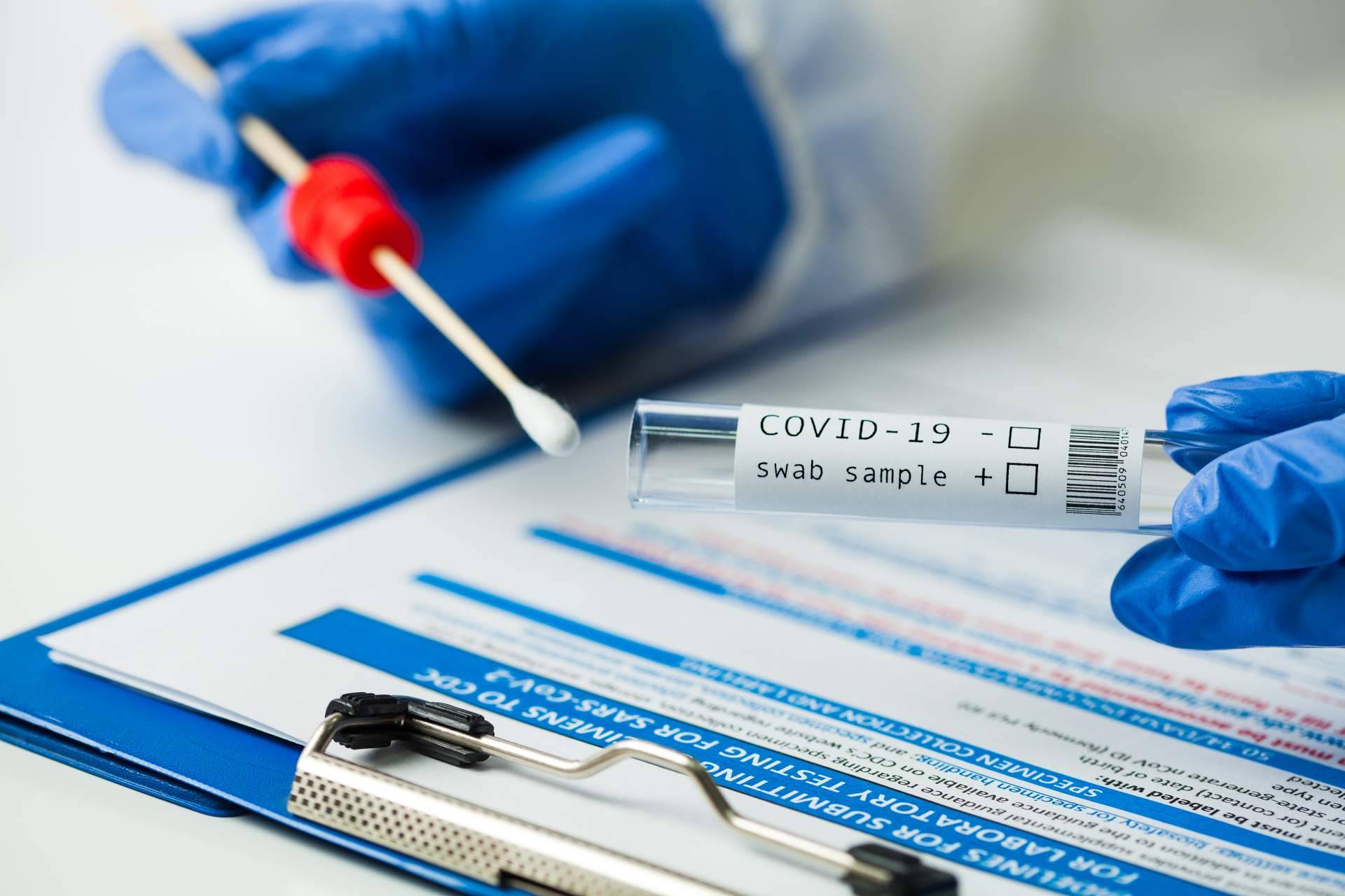 Clínicas VDS: pruebas PCR fiables en Madrid