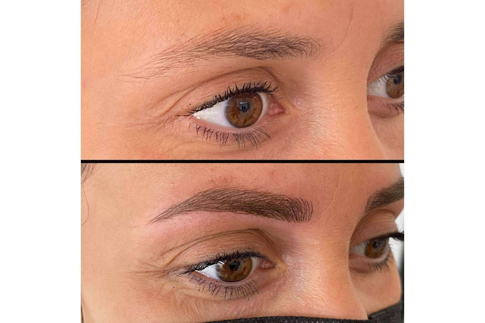Lucir un rostro siempre perfecto con el microblading de la Dra. Julieta Gil
