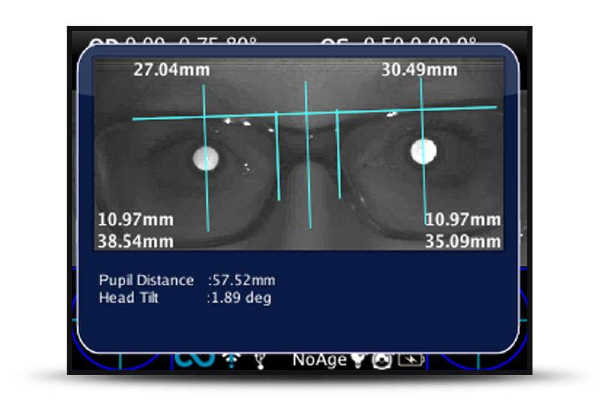 GX2: una de las formas más rápidas de detectar problemas de visión es 2WIN