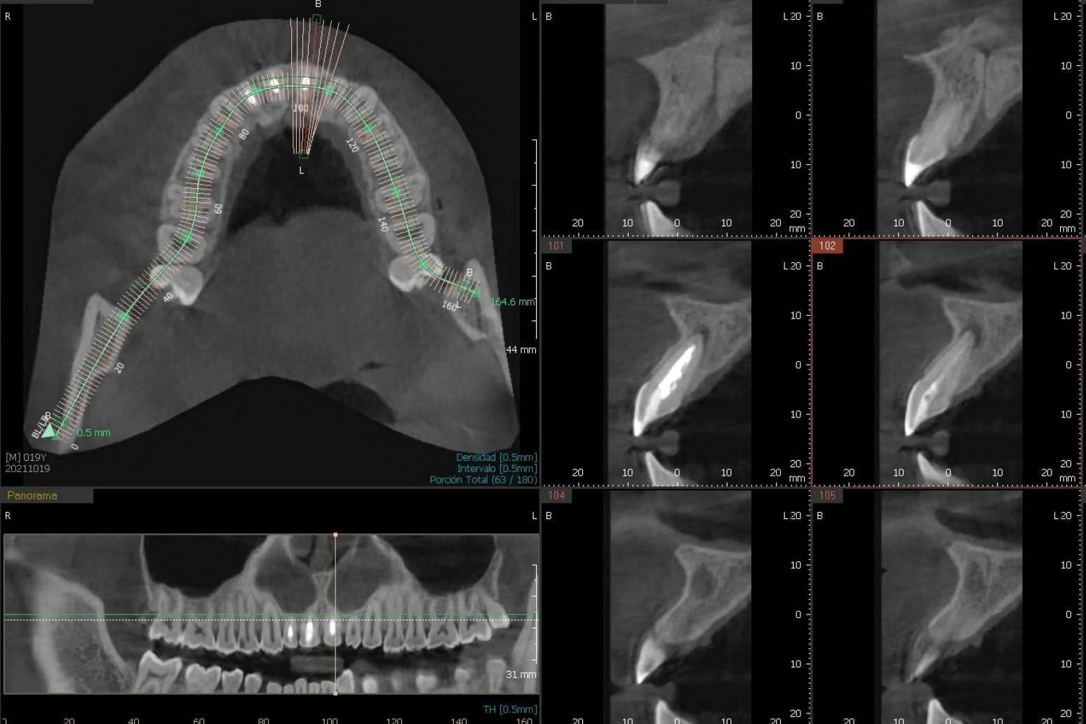 La Clínica Blay+Monzó ofrece a sus pacientes el innovador CBCT dental 3D