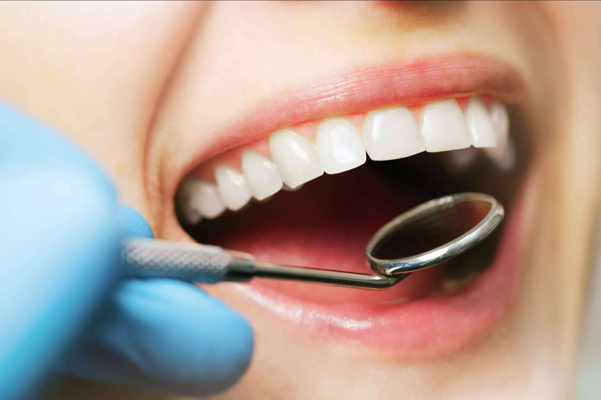 Tecnología y profesionalidad en odontología estética en Sevilla con los profesionales de Clínicas Dental Bell