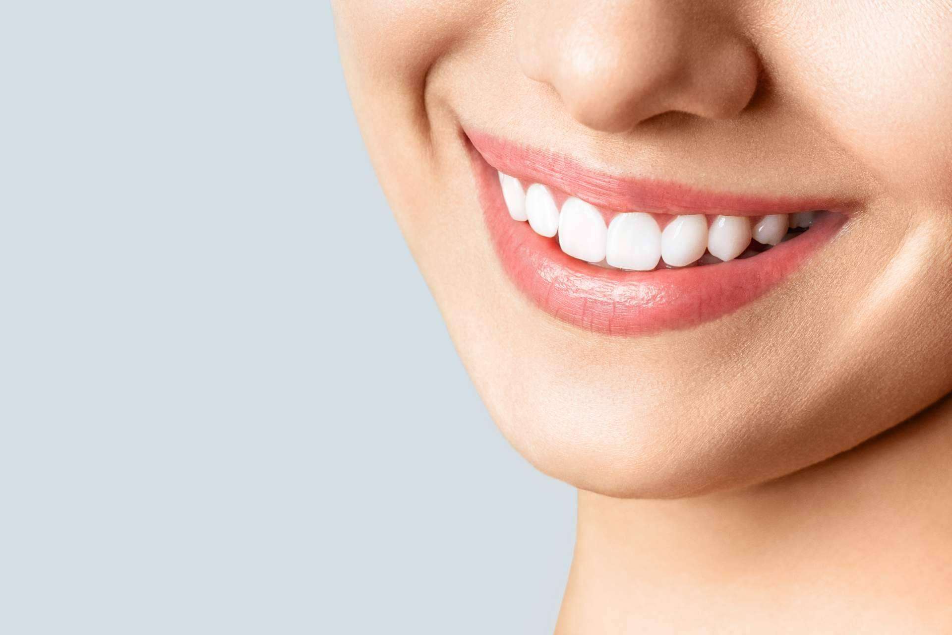 Tratamientos de estética dental en Collblanc para recuperar la sonrisa con Qualident