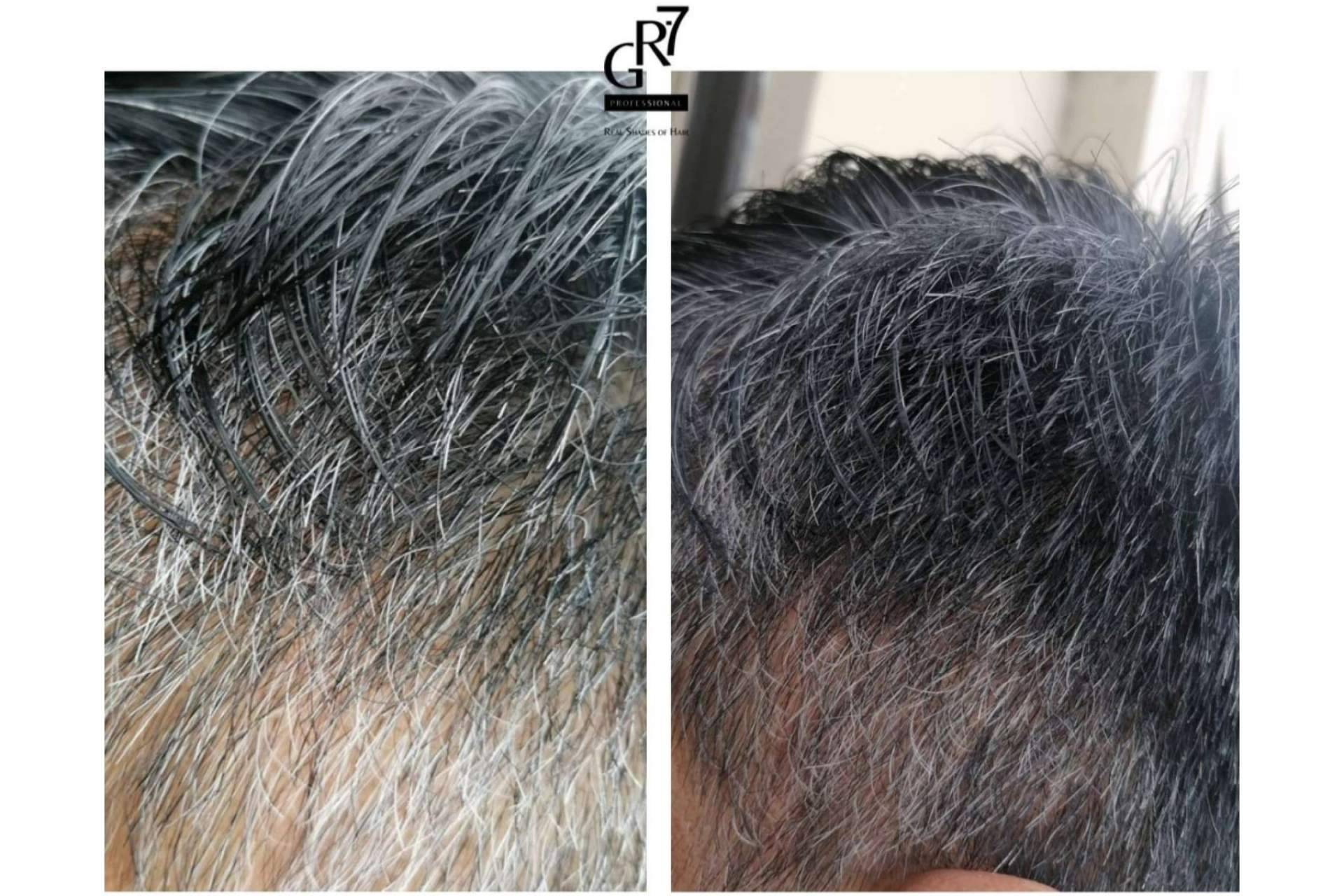 GR-7 Professional explica por qué aparecen las canas y cómo revertir su aparición