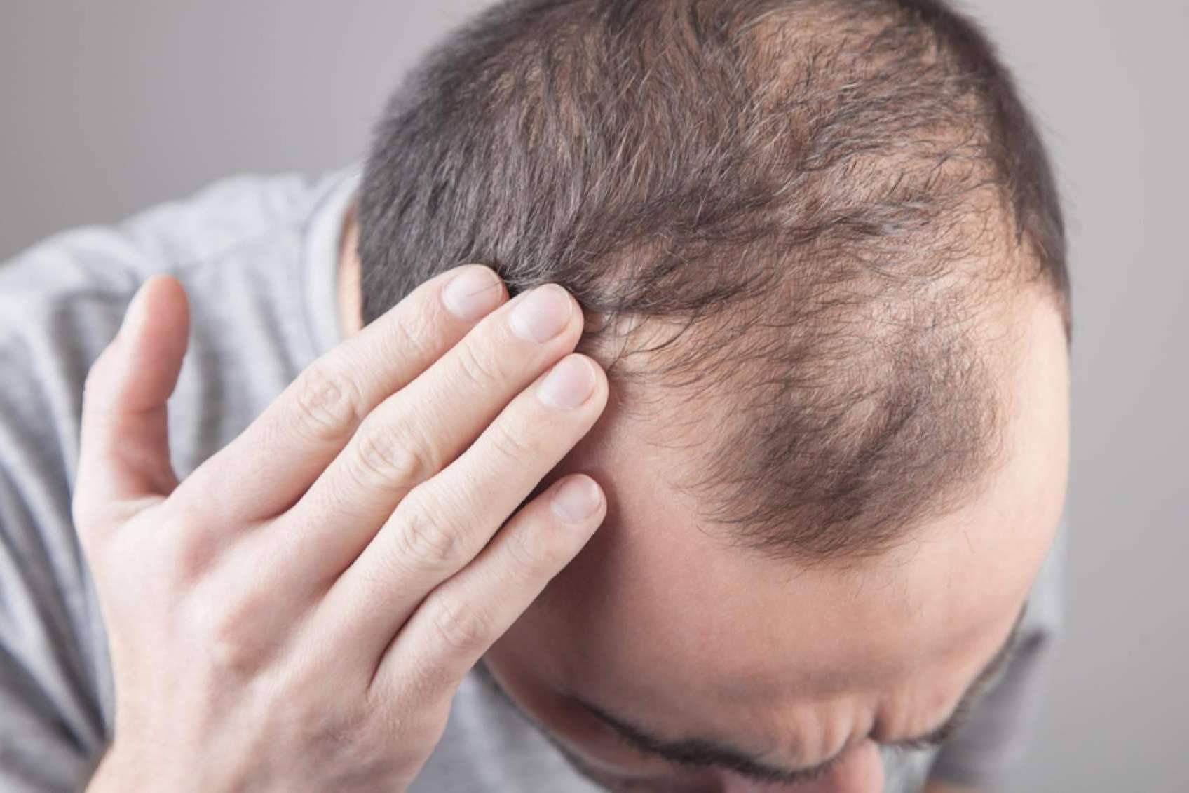 Saw Palmetto dispone de una alternativa para combatir la alopecia, Xpecia Tablet