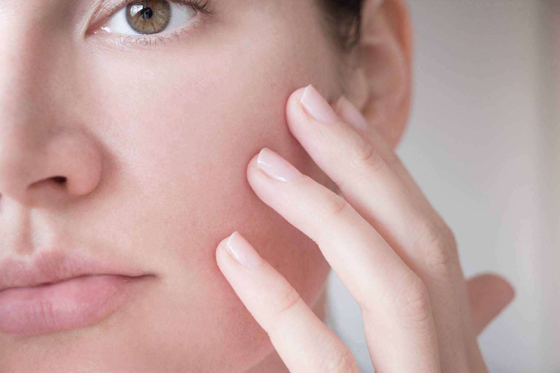 ¿Cómo tratar y prevenir las manchas en la piel en verano?, de la mano de Farmacia Laura Garín