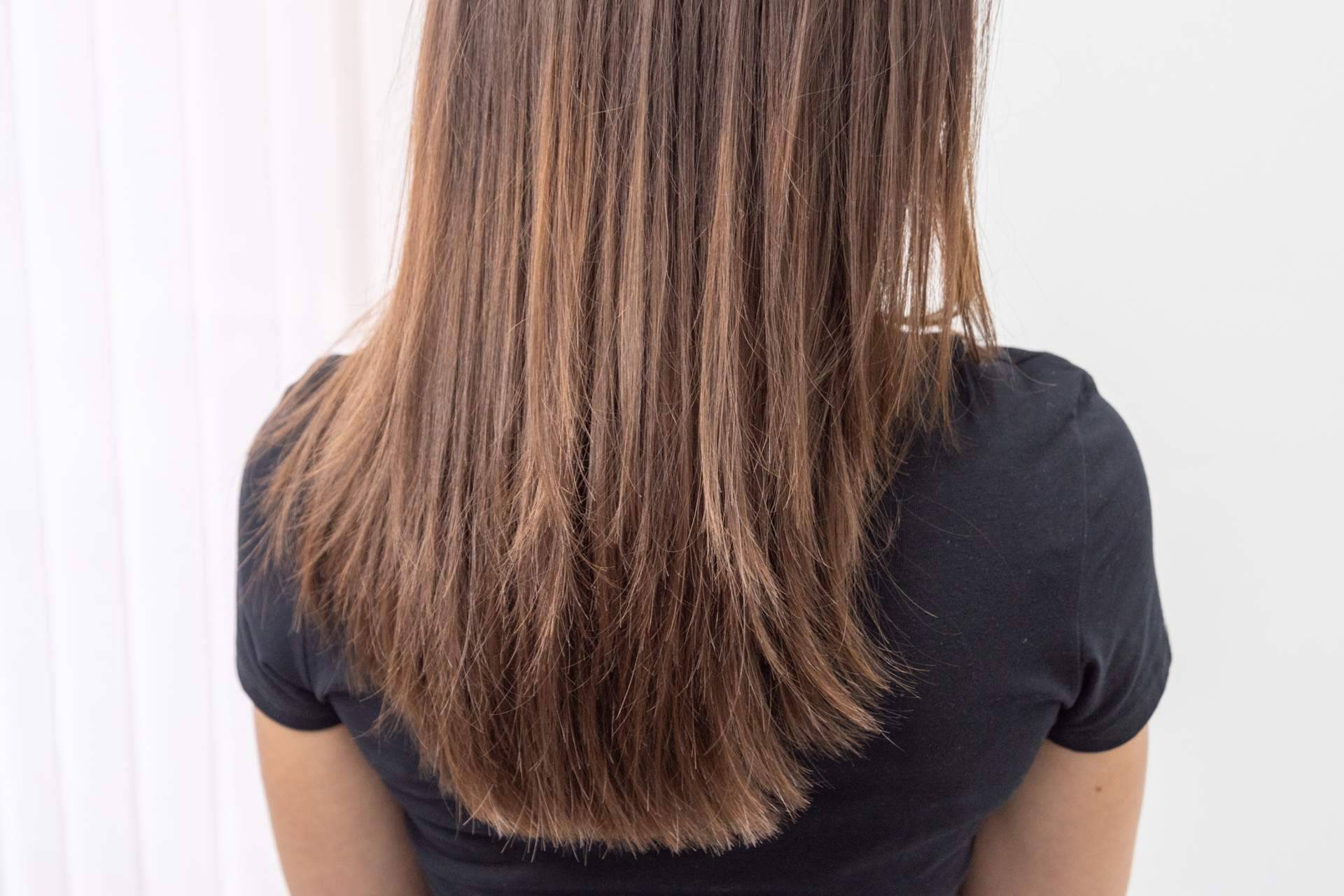 MC360 ayuda a tratar la alopecia e injerto capilar en mujeres