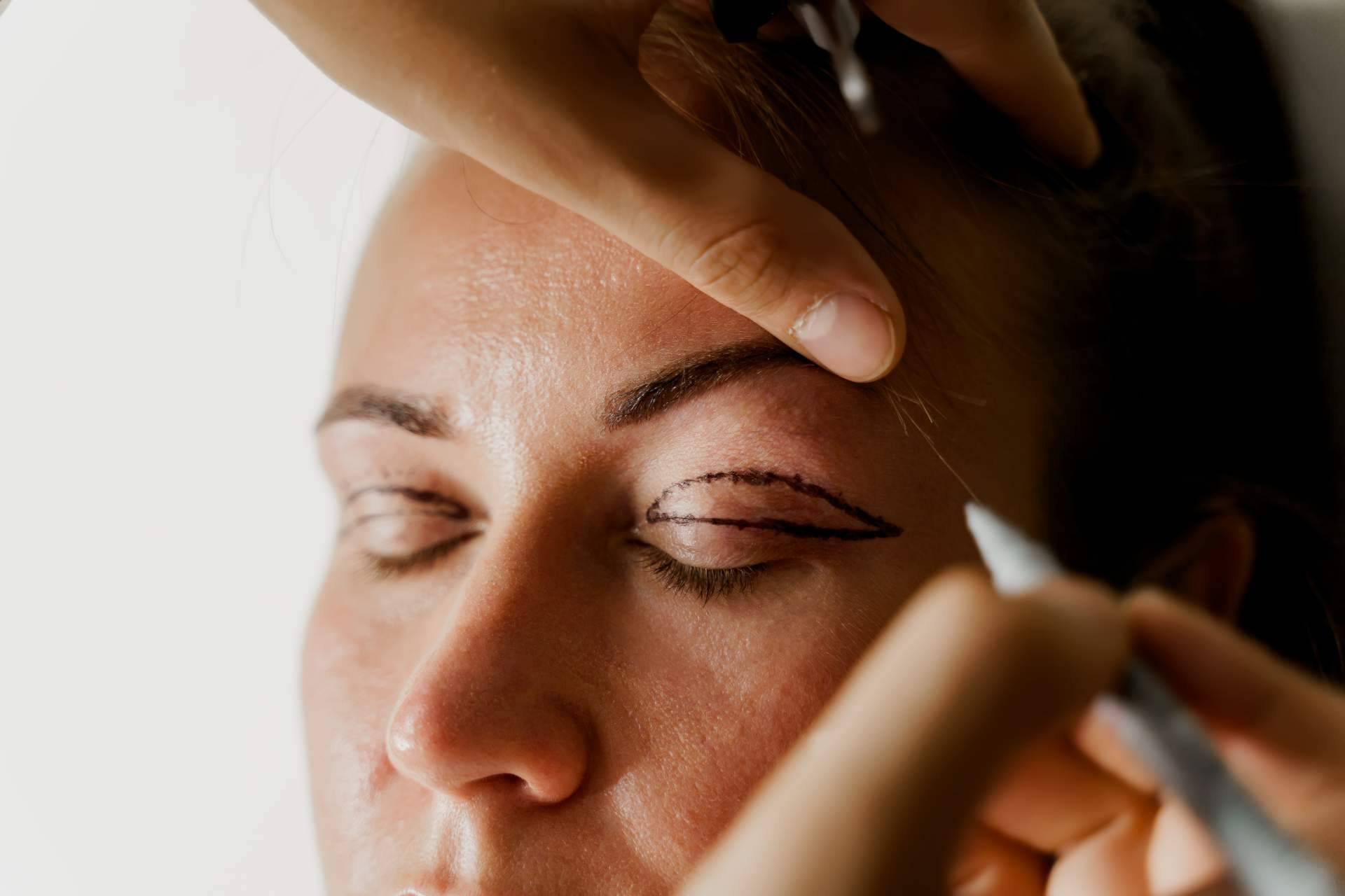 Alluring Clinic, ¿en qué consiste la blefaroplastia no quirúrgica?