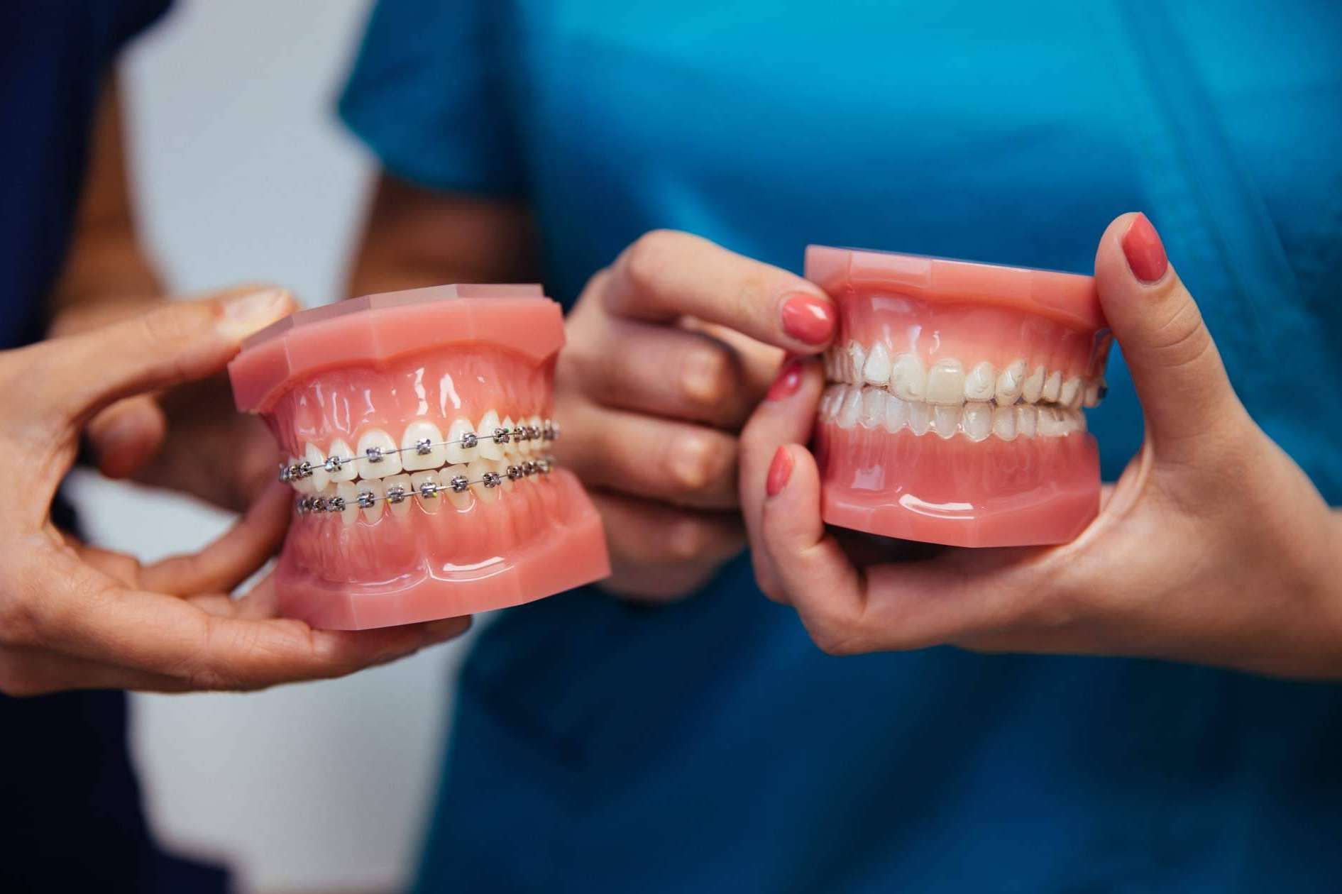 Dientes Redondos explica las 5 ventajas de la ortodoncia invisible Invisalign frente a los brackets