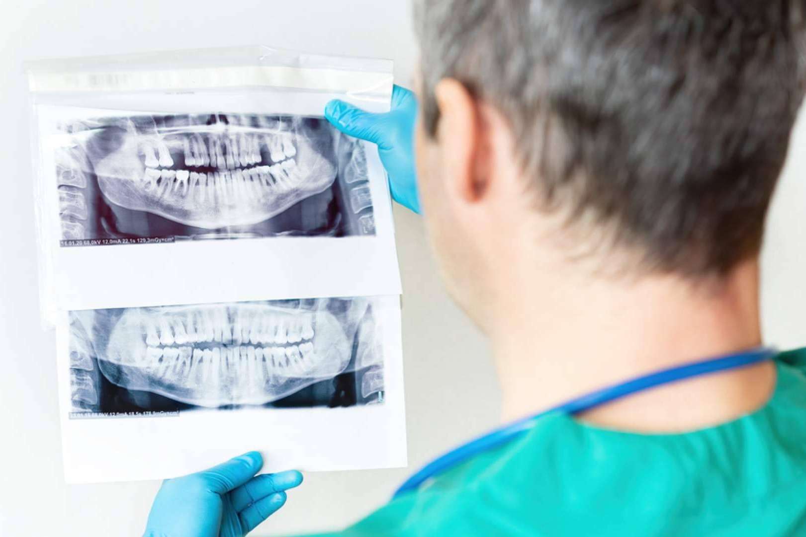 DeltaDent, la clínica dental de Chamartín que brinda una sonrisa perfecta