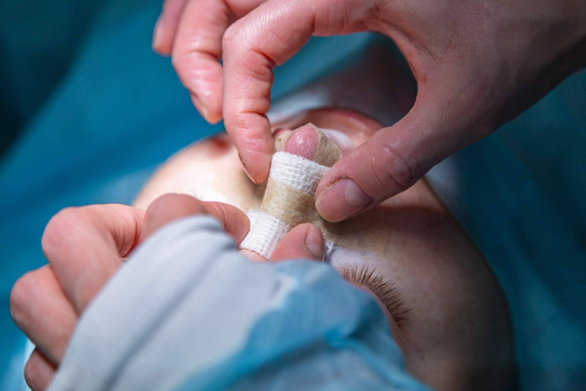 Todo lo que se debe saber sobre la rinoplastia, por Clínica Calvo de Mora