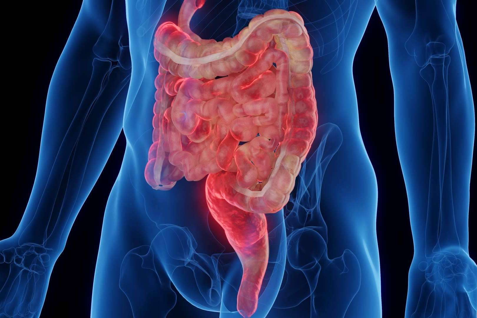 La enfermedad de Crohn