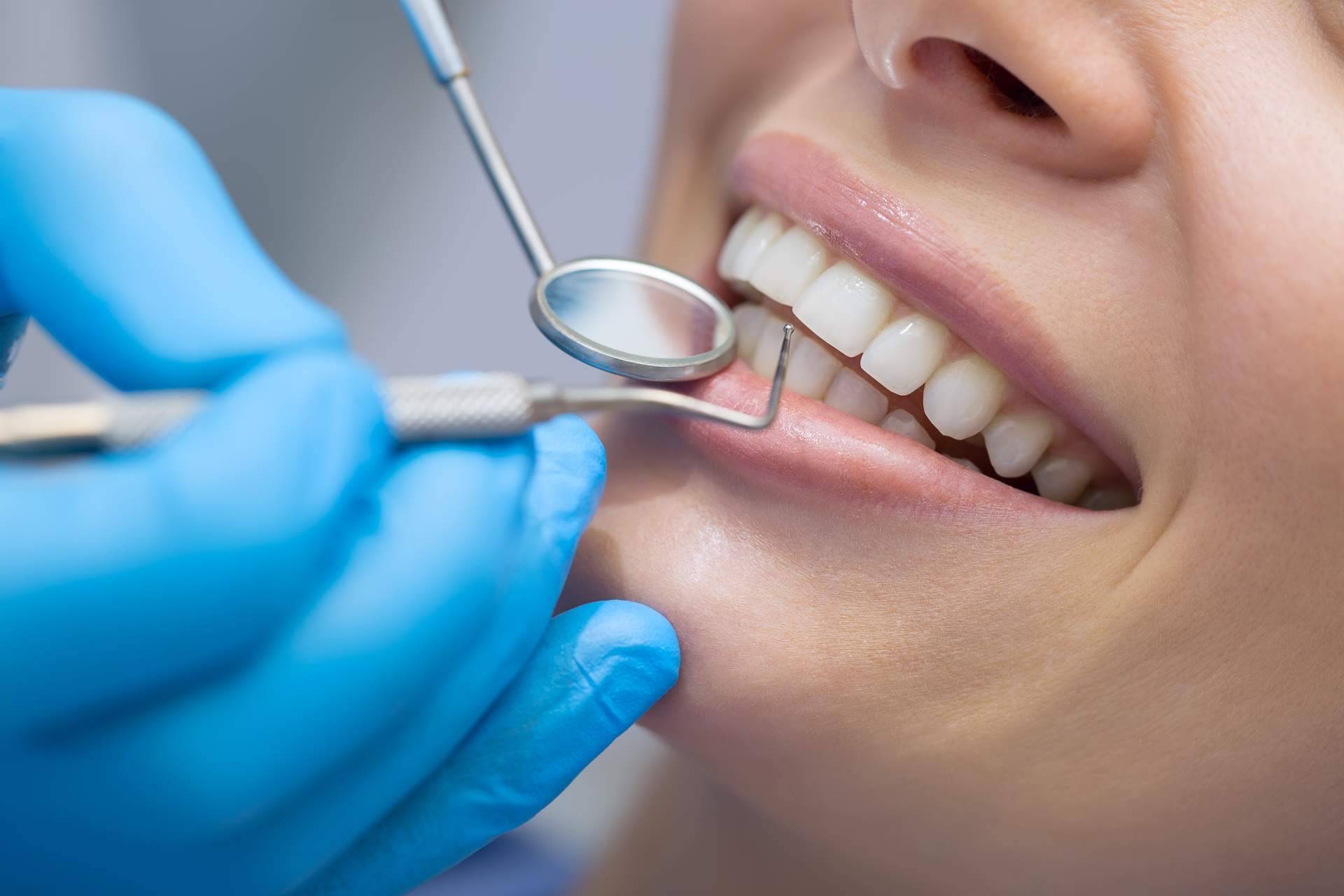Con las carillas dentales, ¿qué problemas se pueden solucionar?
