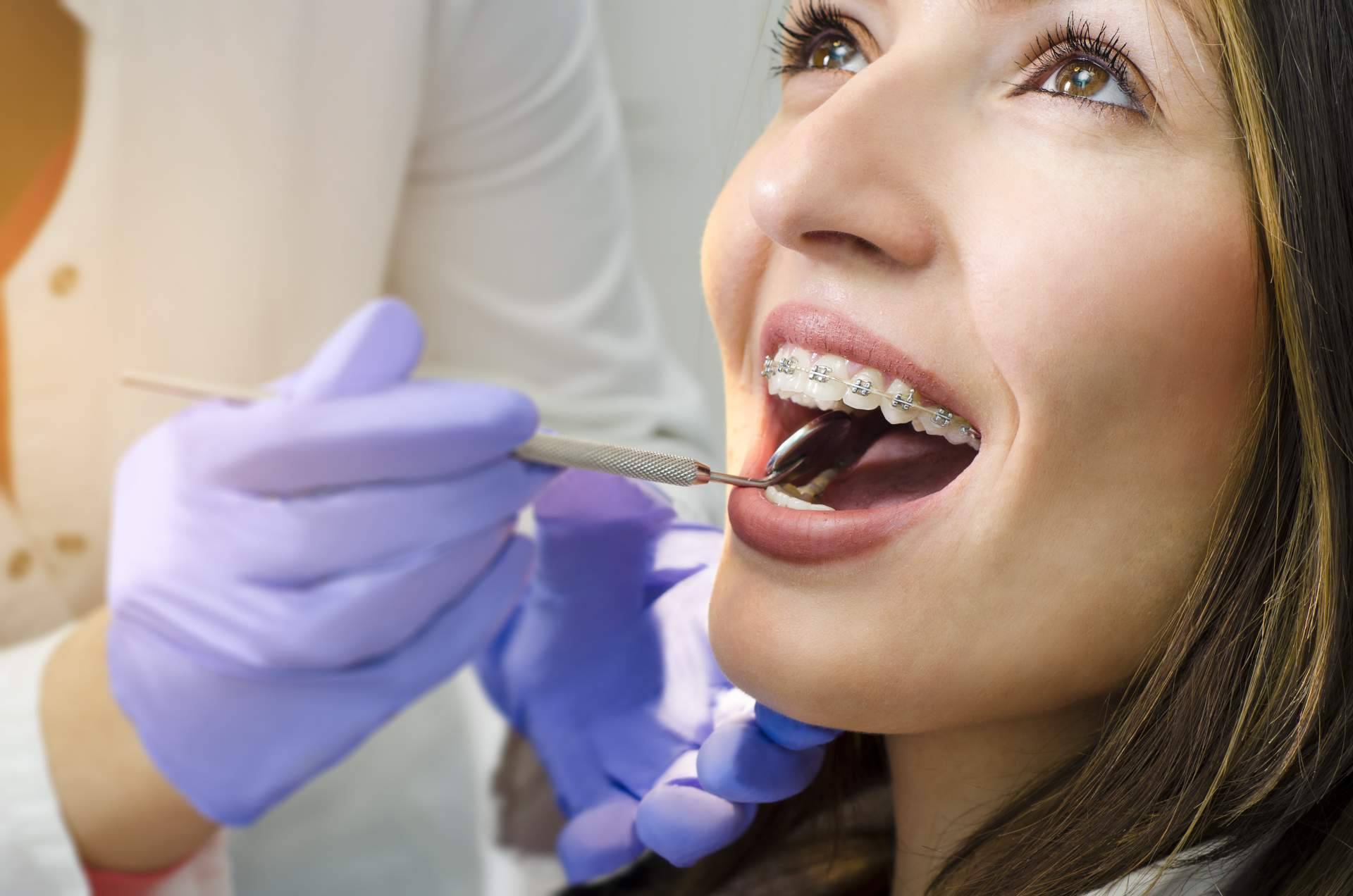 Acudir a centros expertos en ortodoncia como la Clínica Dental Delgado, ¿por qué es importante?