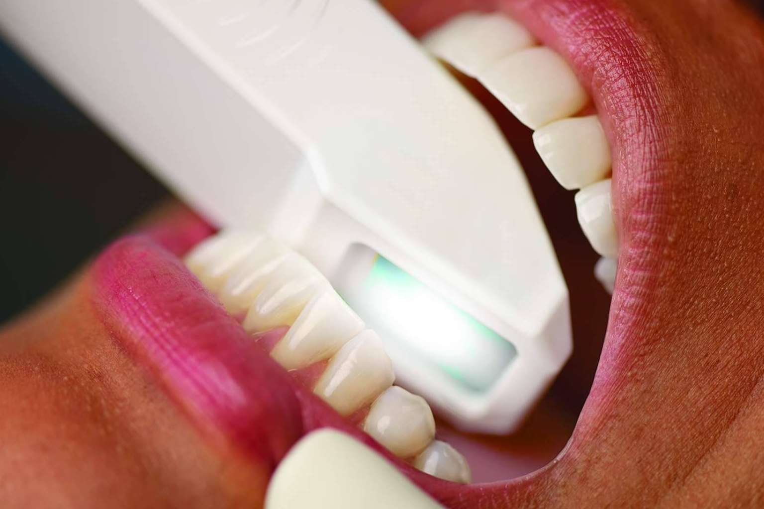 La importancia y las claves de la estética dental, por el Instituto Odontológico Volpe