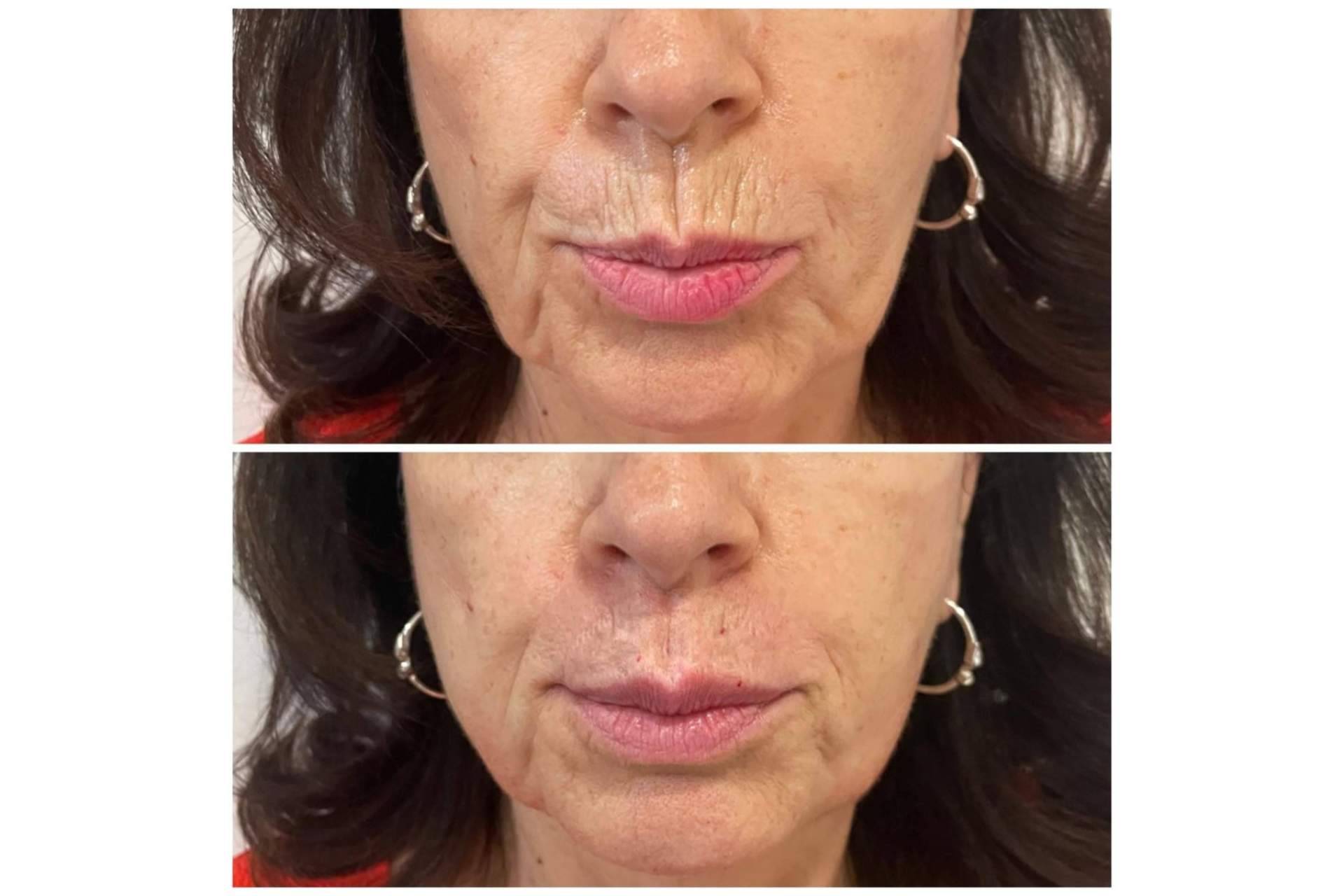 Clínica estética Cecilia Arthur, especialistas en blanching