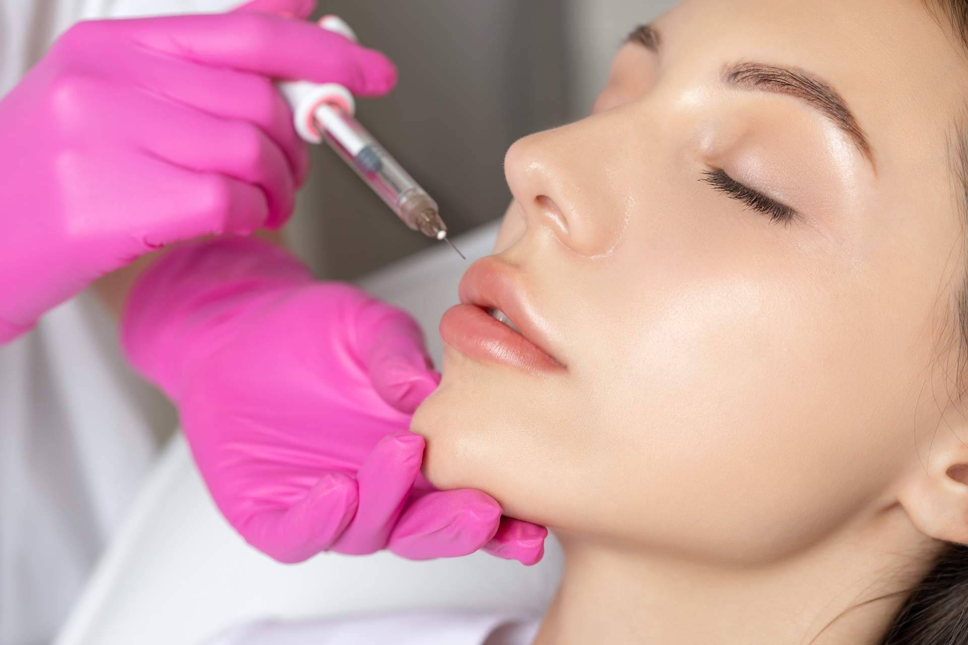 Tratamiento de hidratación de labios con ácido hialurónico en España, con 360Clinics