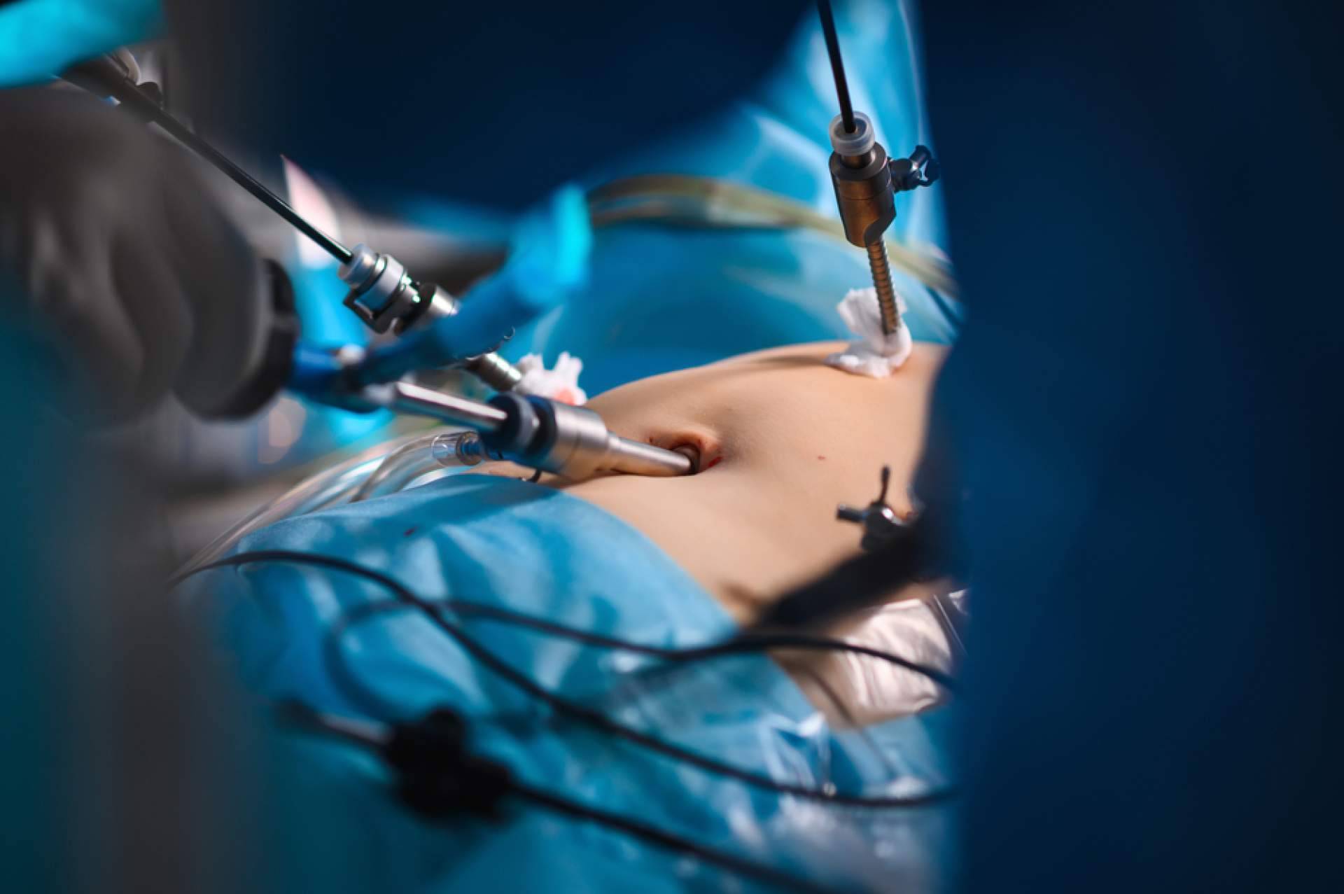 Acerca de la cirugía de hernia inguinal, resolver dudas de la mano del Dr. Javier Martínez Pascuas