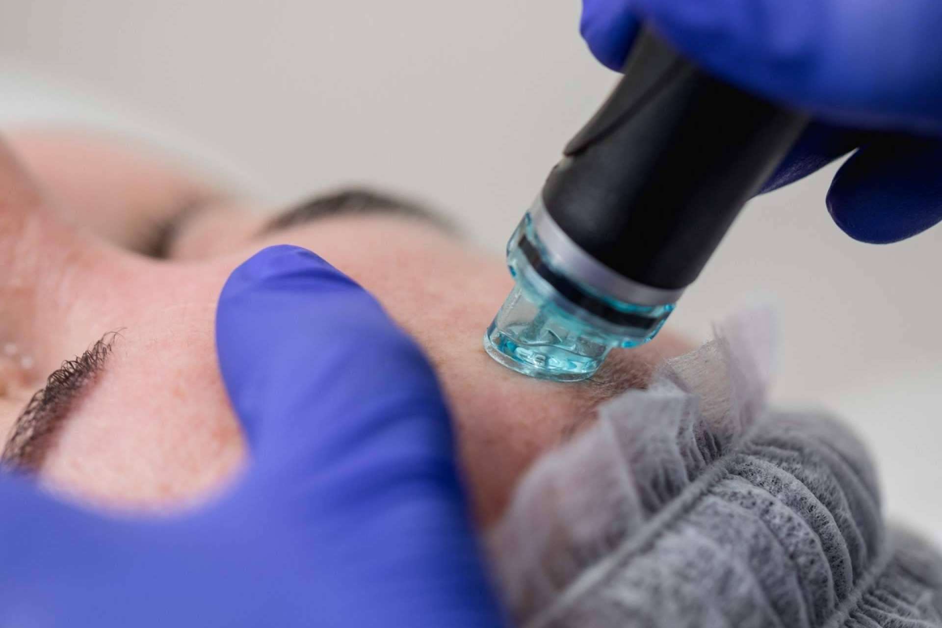 Hydrofacial, el tratamiento estrella que llega a Oviedo de la mano de la Clínica Sánchez del Río
