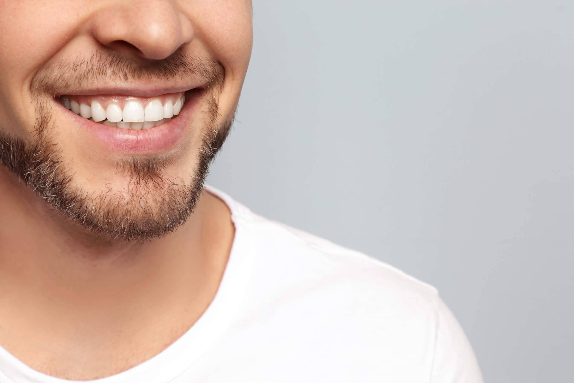 ¿En qué consiste la cirugía de sonrisa gingival?