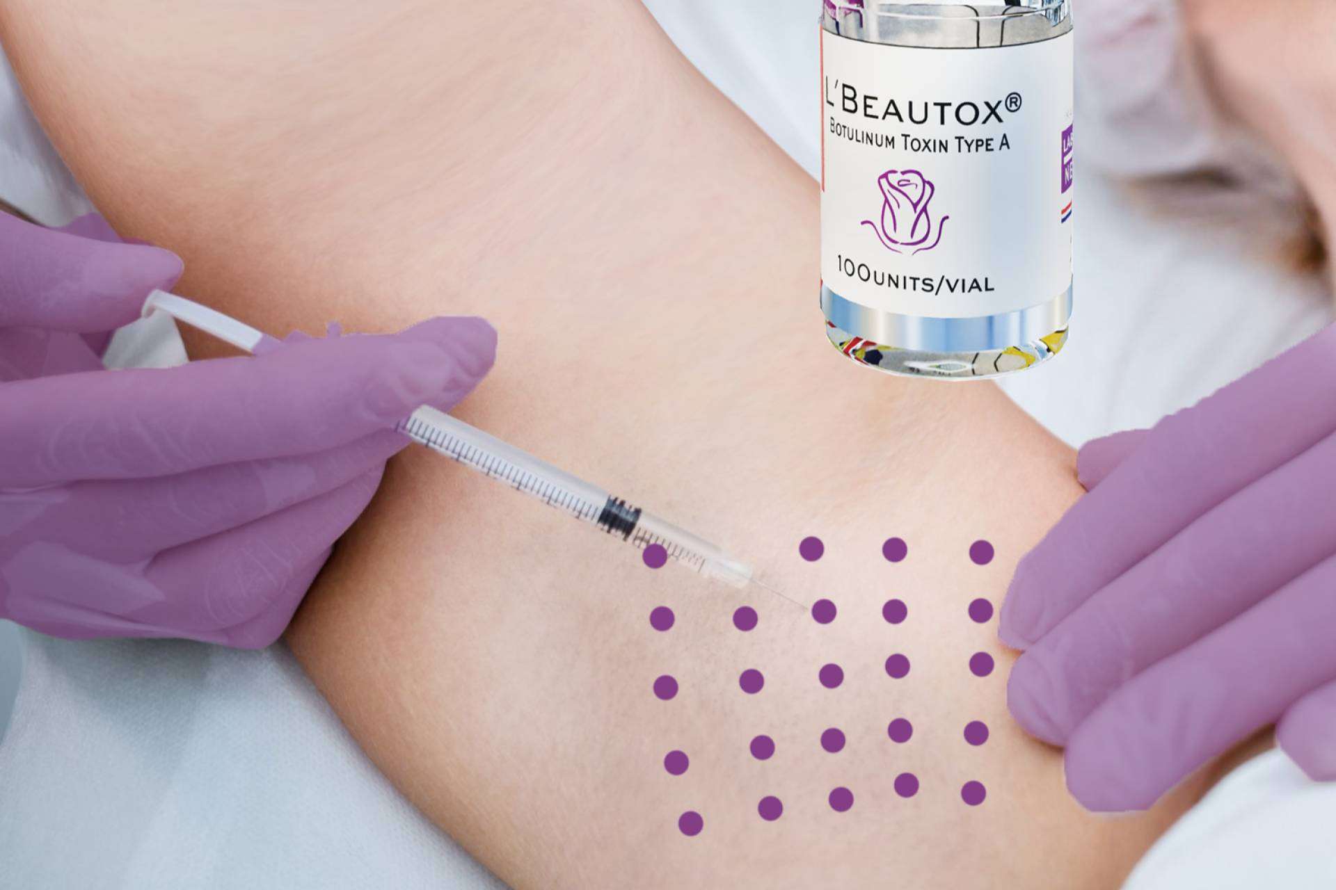 Toxina Botulínica LBEAUTOX, un avance efectivo en el tratamiento de la hiperhidrosis