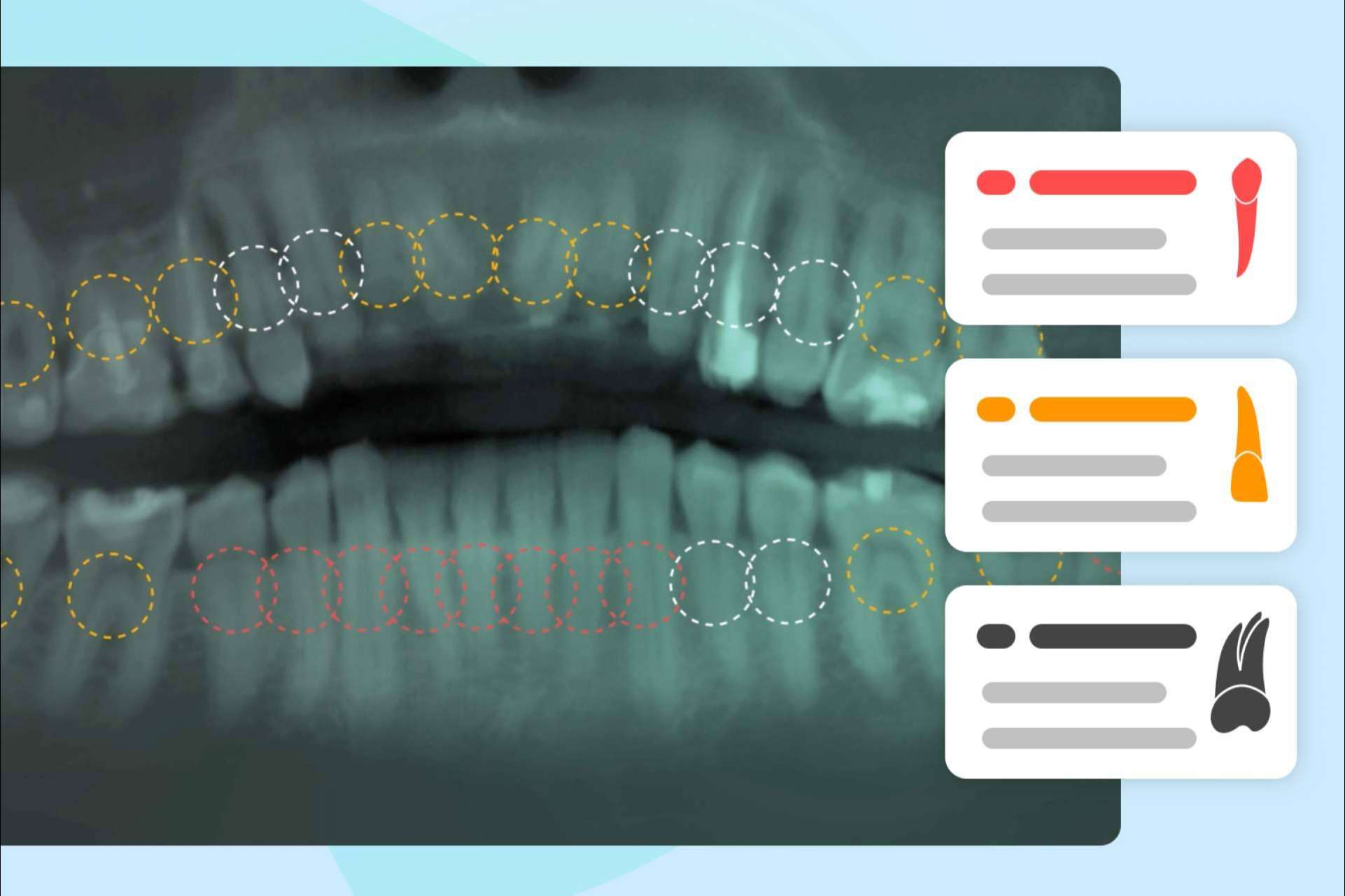 Dentomo y su software dental IA