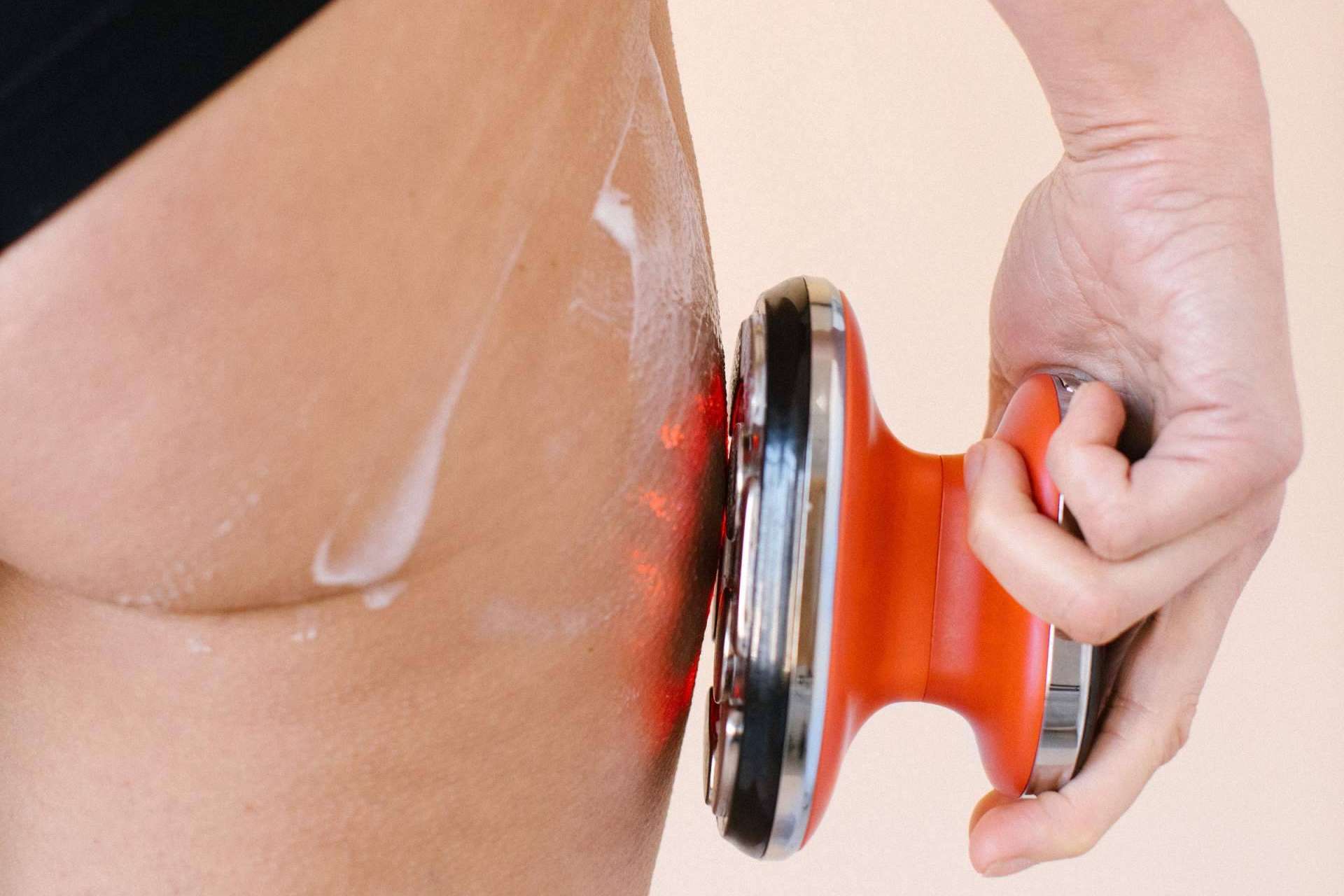 Cuáles son las ventajas de la radiofrecuencia facial y corporal, por Masderm