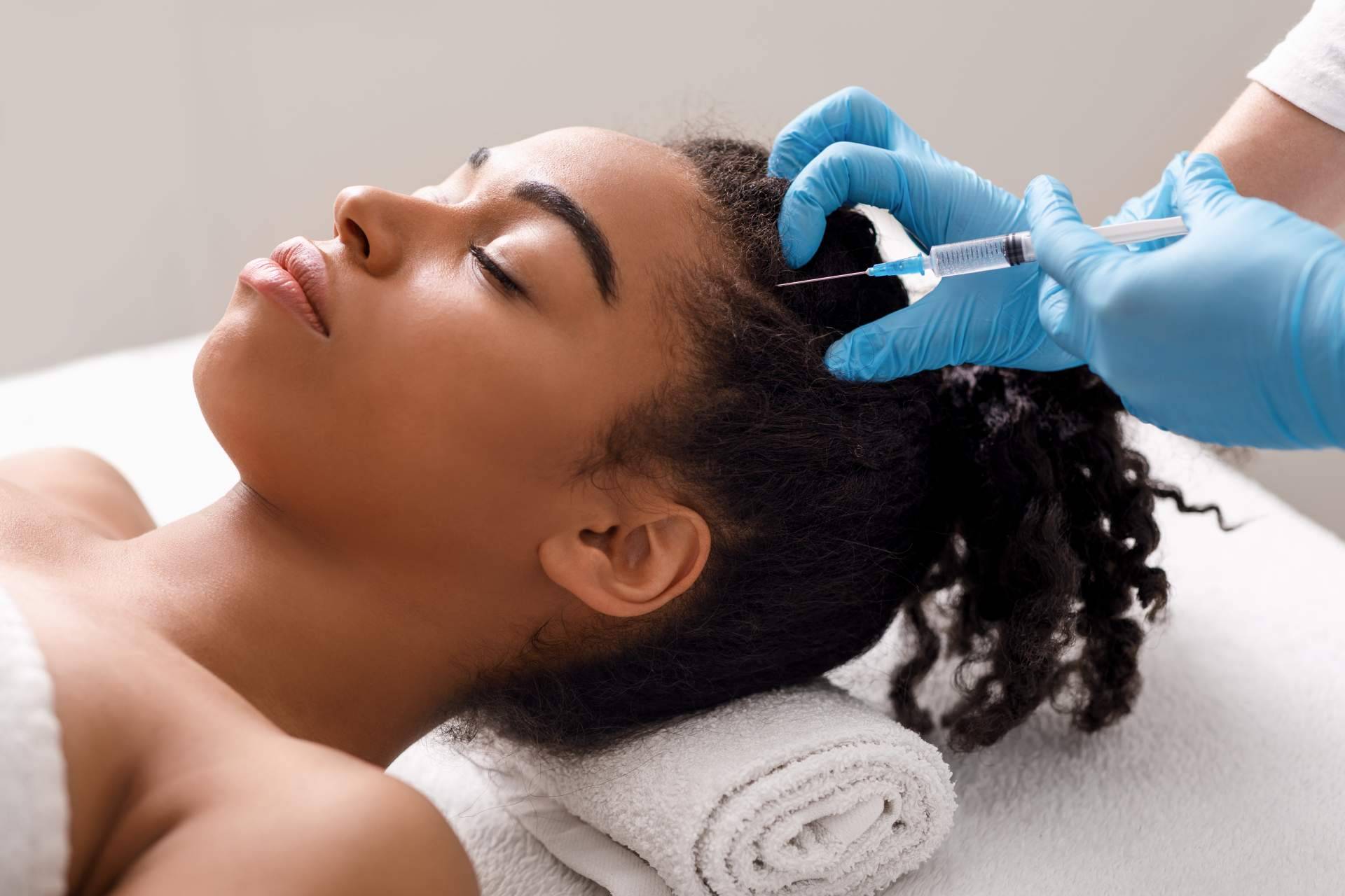 Alluring Clinic ofrece un tratamiento de la alopecia androgenética con exosomas