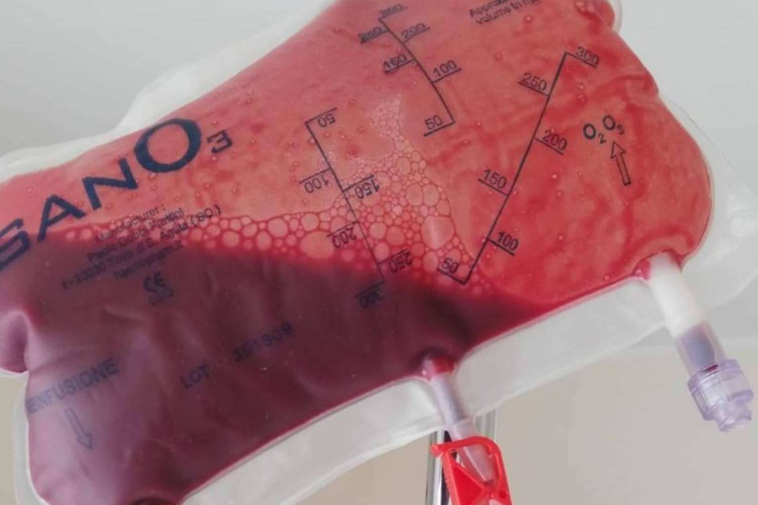 La ozonoterapia como método médico eficaz para tratar los trastornos de la diabetes