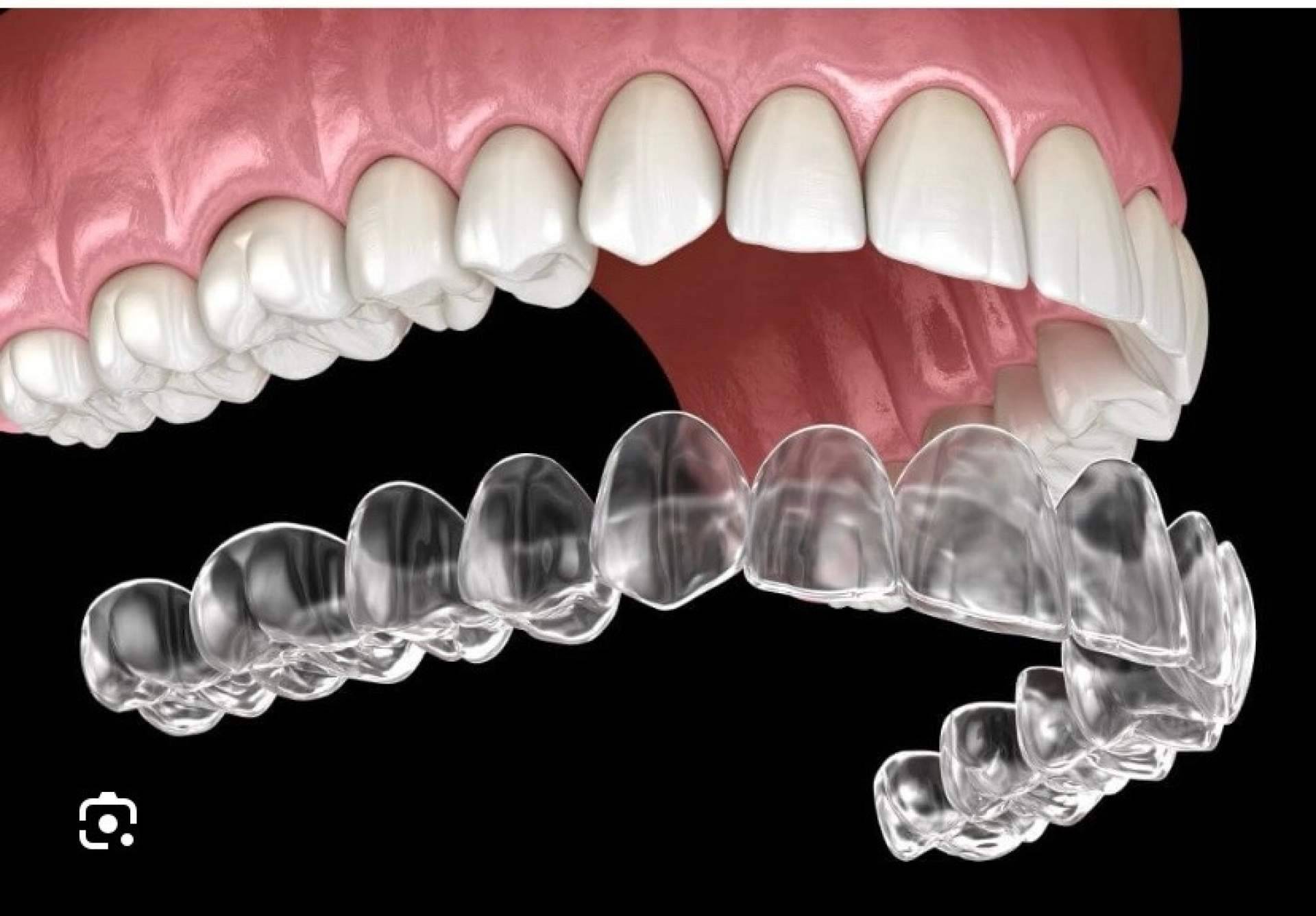 Clínica Dental Jorge del Corral posiciona la ortodoncia invisible como tratamiento clave en su clínica dental en Hortaleza