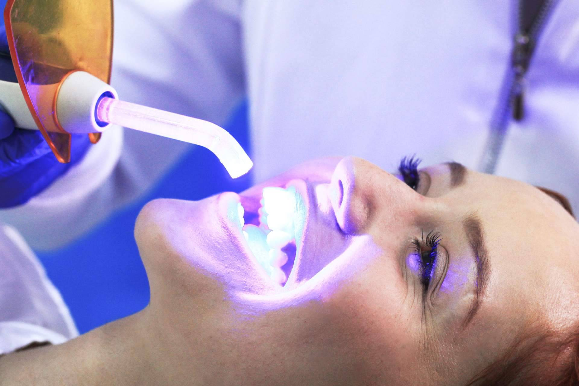 Odontología de Marlon Becerra, clínica de blanqueamiento dental en Bogotá y estética bucal integral